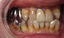 術前口腔内写真