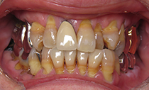 術前口腔内写真