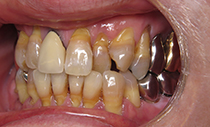 術前口腔内写真